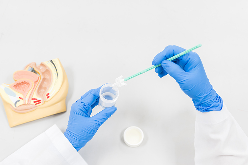 A doctor collecting samples from a cervical cancer screening test