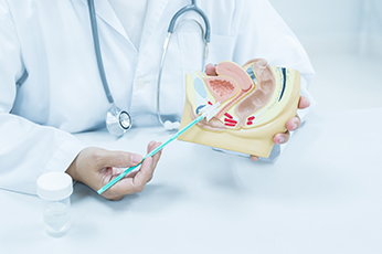 Monitoring for Recurrence in Cervical Cancer Patients